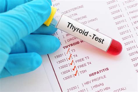 tsh blood test prep